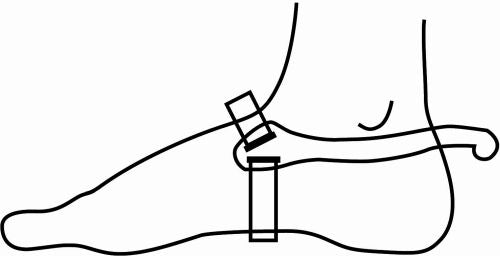 Sprenger Ultra Fit Hammer Head Spurs